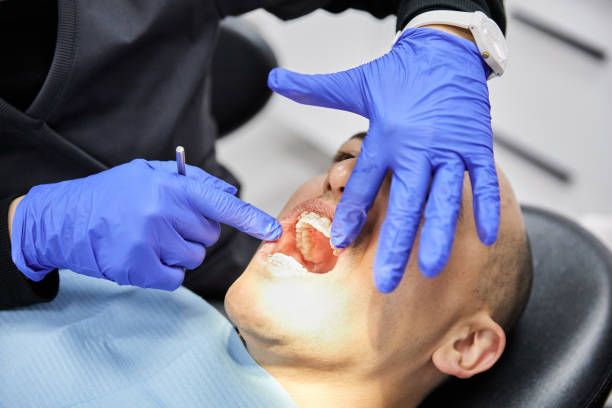 Best Emergency Wisdom Tooth Extraction in Keyser, WV